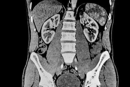 'There is a dire lack of ... studies'
