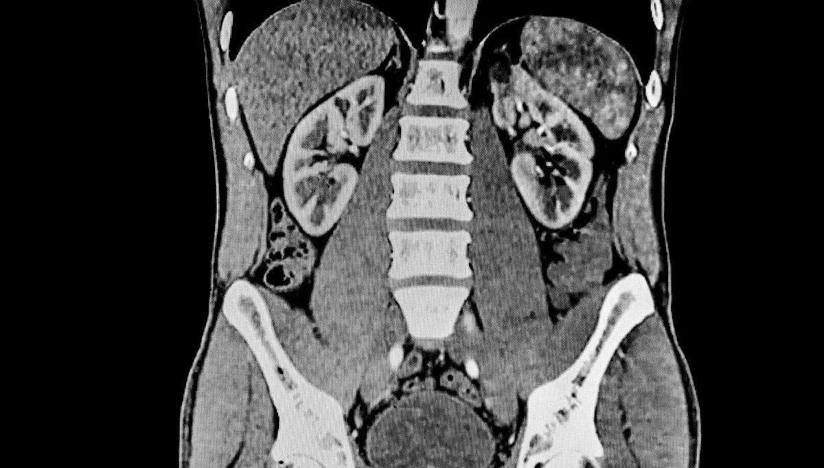 'There is a dire lack of ... studies'