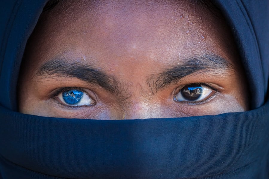 Butonese girl with beautiful eyes, one blue and one brown